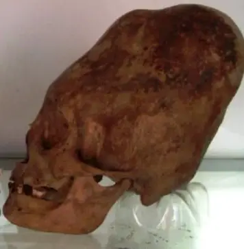 ¿Los cráneos alargados de Paracas se inspiraron en el contacto extraterrestre o en una antigua costumbre?