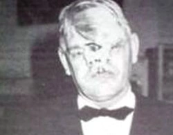 The Tragic Life of the Man with Three Eyes, Two Noses, and a Split Face: An Unwilling Star