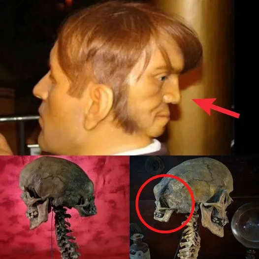 Unraveling the Enigma of the Two-Headed Skull: Probing Archaeological Autopsies for Hidden Clues