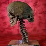 Unraveling the Enigma of the Two-Headed Skull: Probing Archaeological Autopsies for Hidden Clues