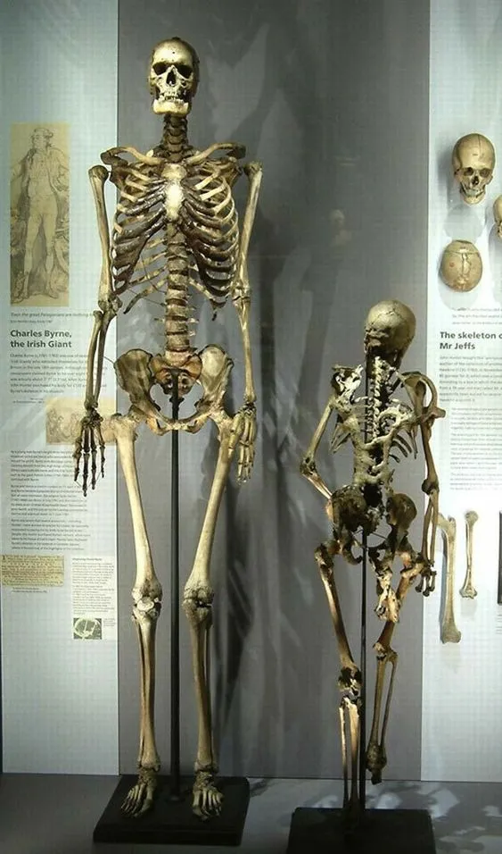Next to a Giant's Femur: A Man Nearly 2 Meters Tall Looks Tiny Next to an Ancient Monster.
