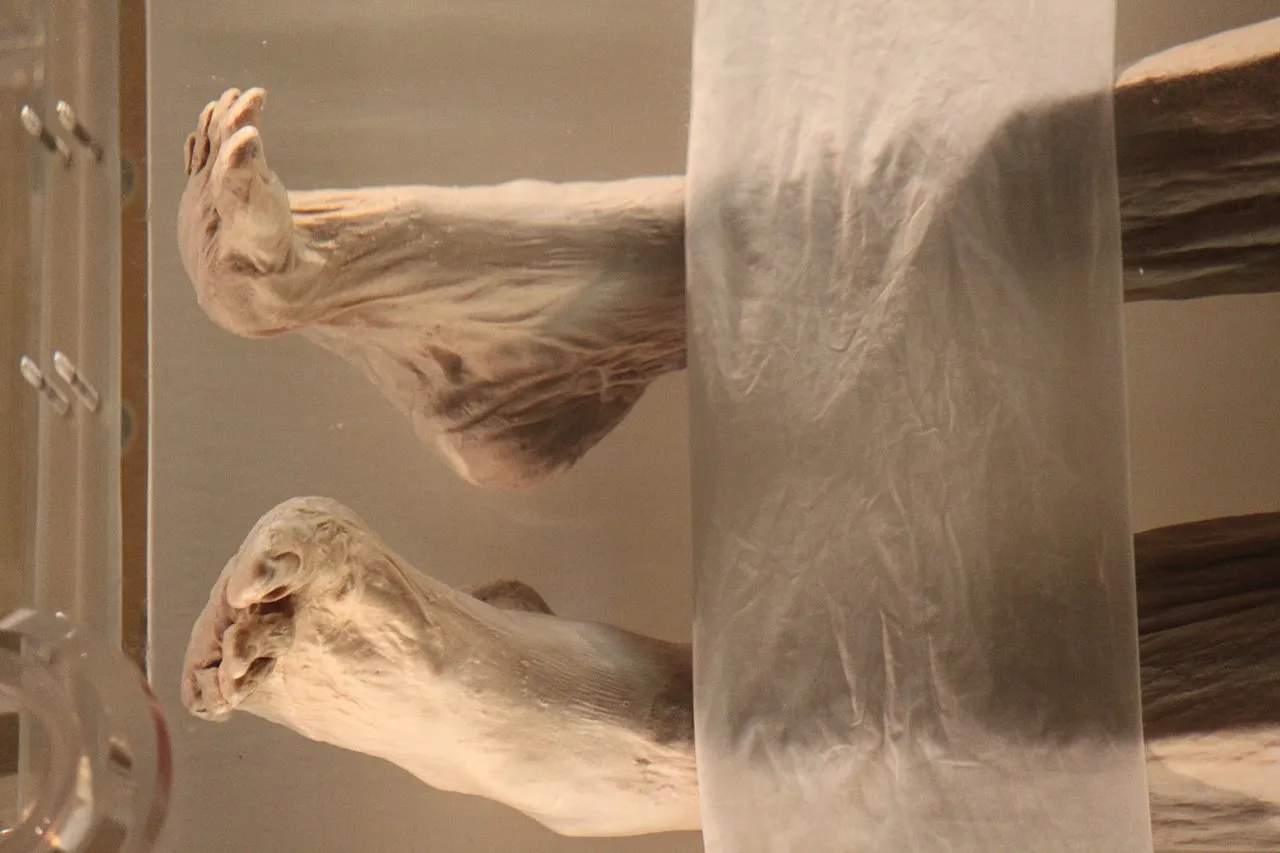 A Chilling Discovery: The Mummy of Lady Dai and the Disturbing Diseases Locked Inside