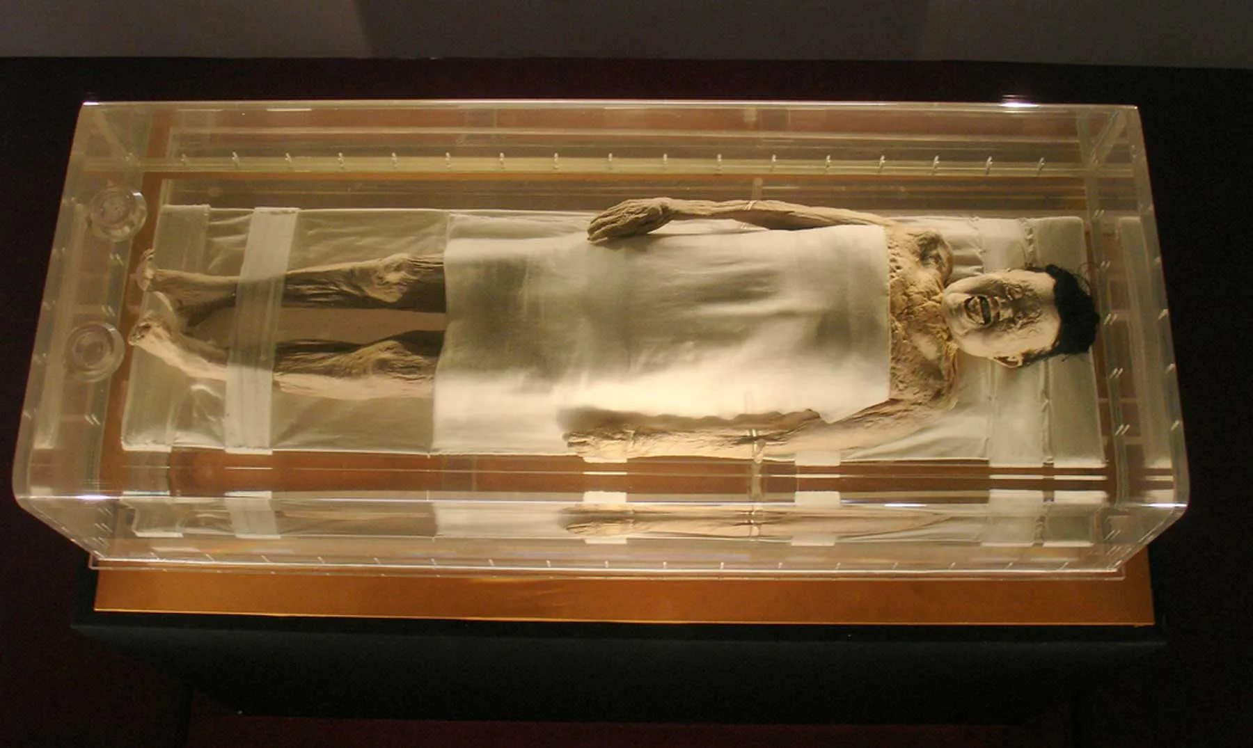 A Chilling Discovery: The Mummy of Lady Dai and the Disturbing Diseases Locked Inside