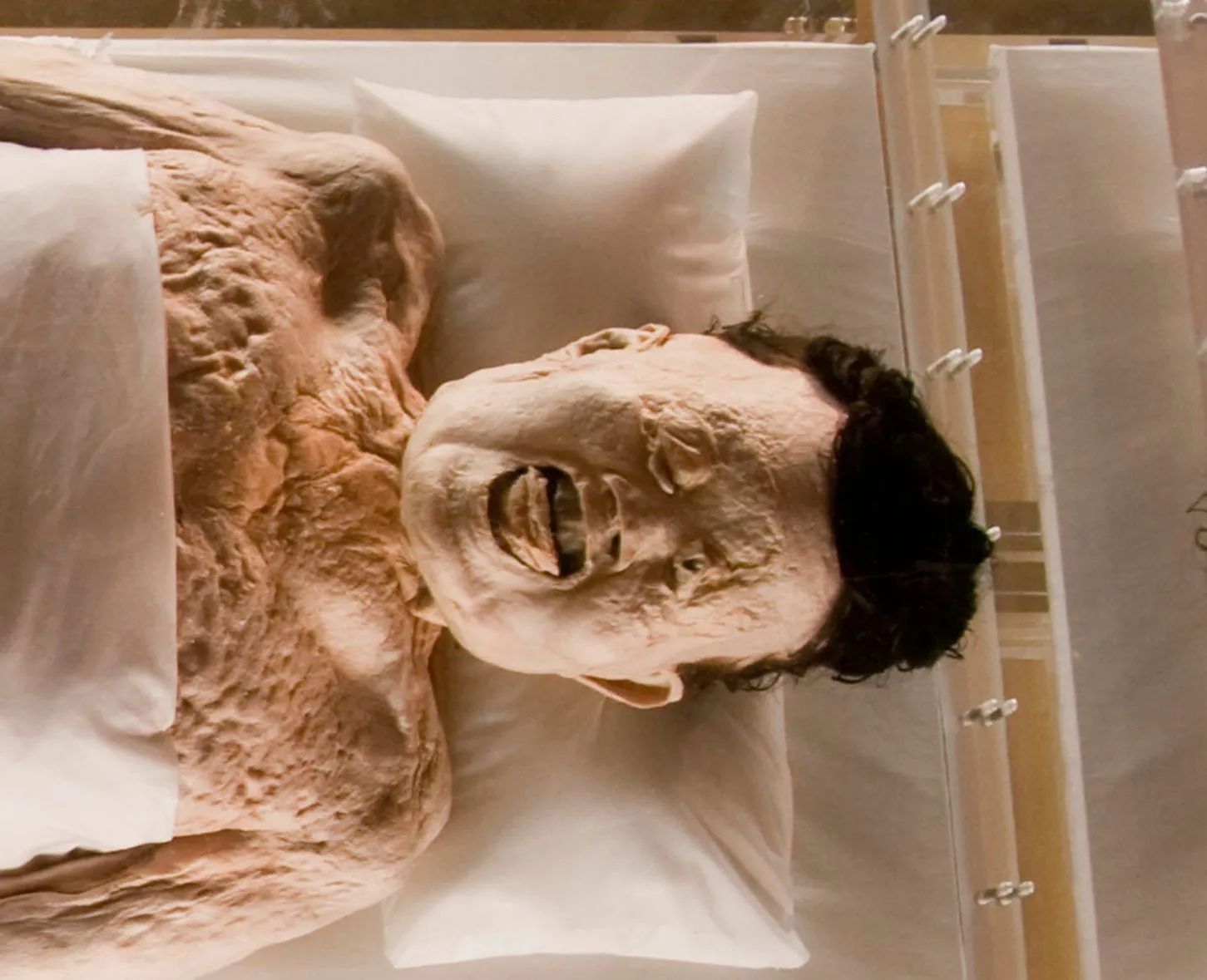 A Chilling Discovery: The Mummy of Lady Dai and the Disturbing Diseases Locked Inside
