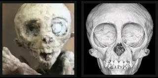 Breaking News: Shocking Revelation – Mexico’s Mysterious Babies Confirmed as Real Aliens!