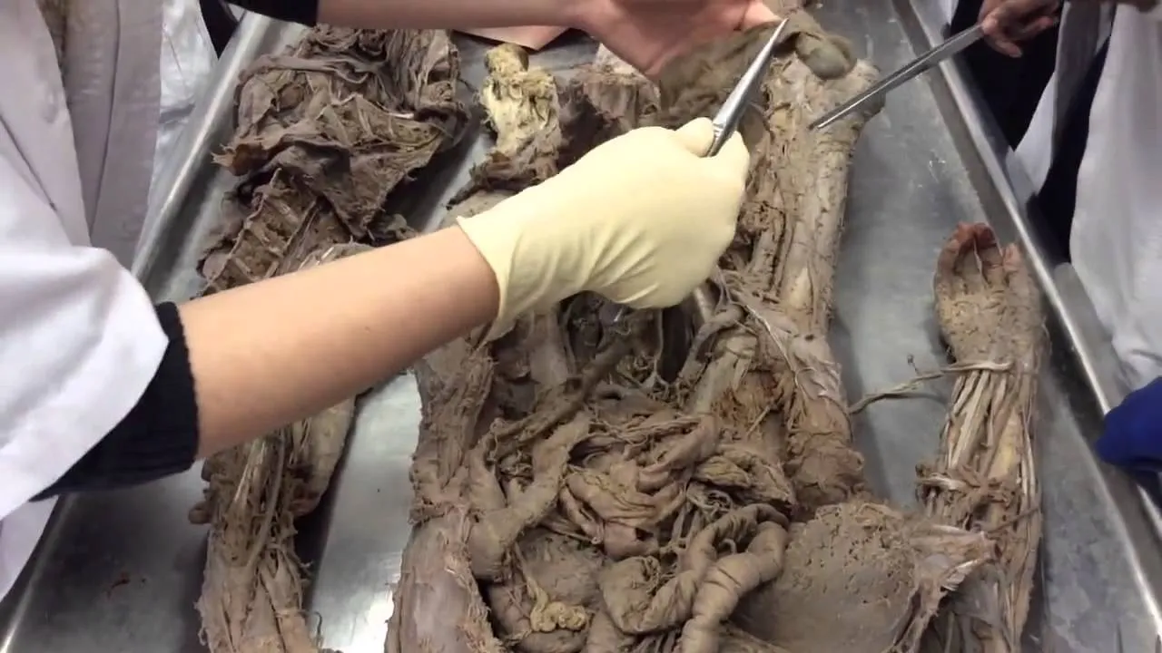 Shocking Revelation: ‘The Screaming Mummy’ – New Advanced Scientific Techniques Illuminate Her 3,500-Year-Old Painful Death