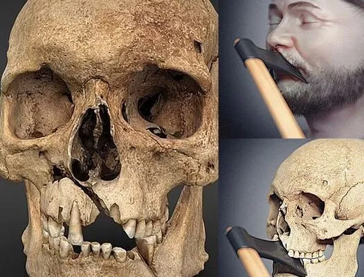 Medieval Warrior's Face from 1361 Recreated from Battle-Damaged Skull