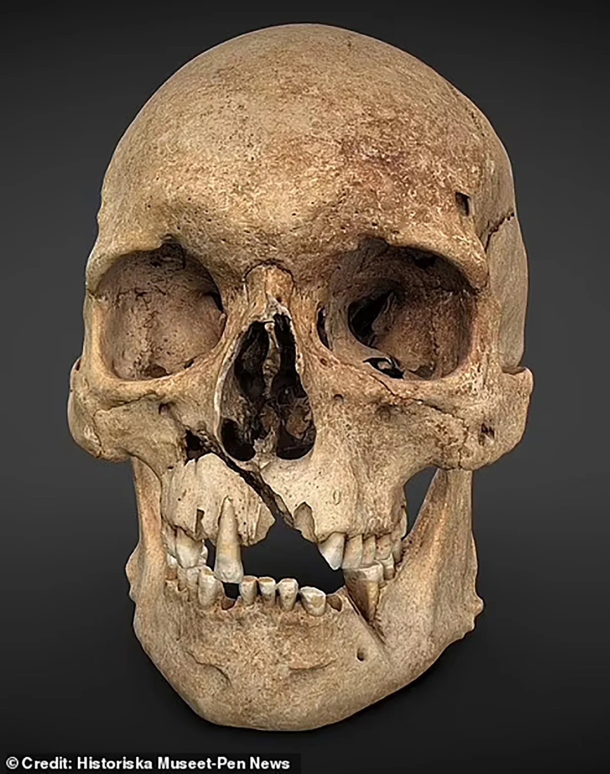 Medieval Warrior's Face from 1361 Recreated from Battle-Damaged Skull