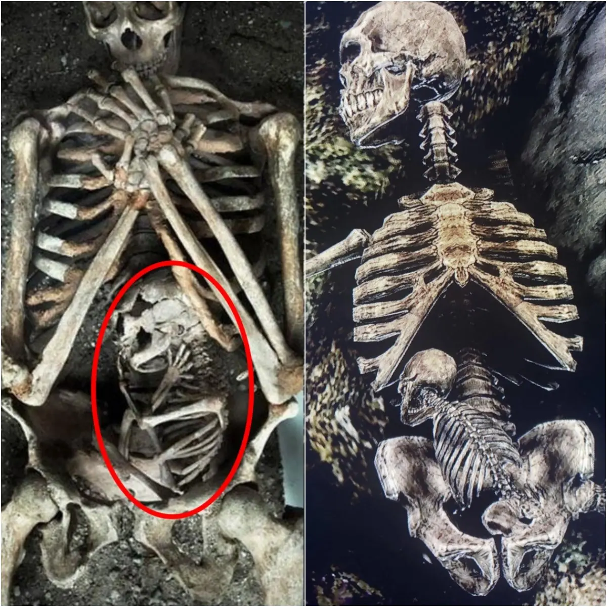 Haunting Find: Archaeologists Unearth the Skeletons of a Pregnant Mother and Her Fetus—A Discovery That Sends Chills Down the Spine of Experts