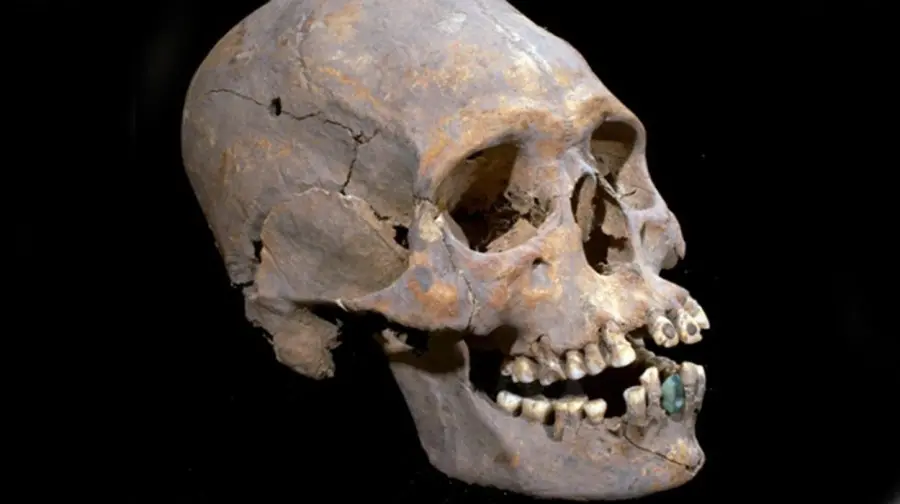 Rare Treasures Discovered in Teeth Unearthed in a Mexican Cemetery