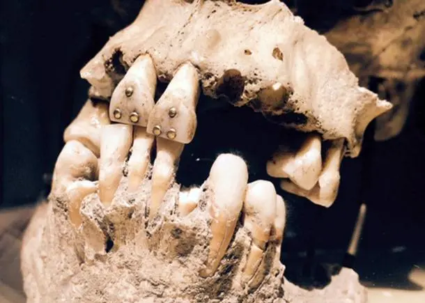 Rare Treasures Discovered in Teeth Unearthed in a Mexican Cemetery