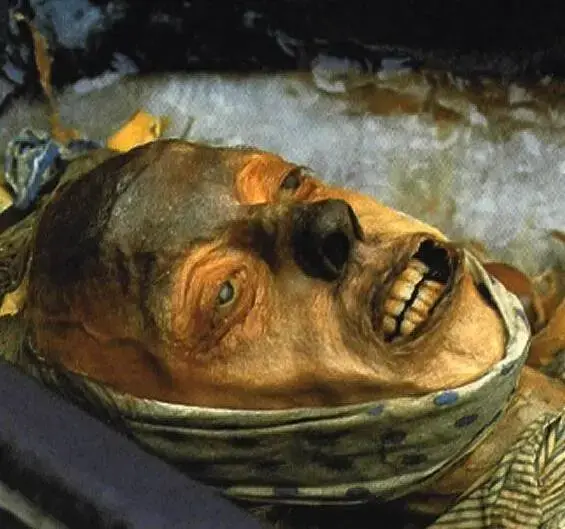 The Most Scandalously Preserved Mummy Ever Found: Unearthed at Franklin Execution Site in 1845, Revealing Chilling Secrets of the Past.
