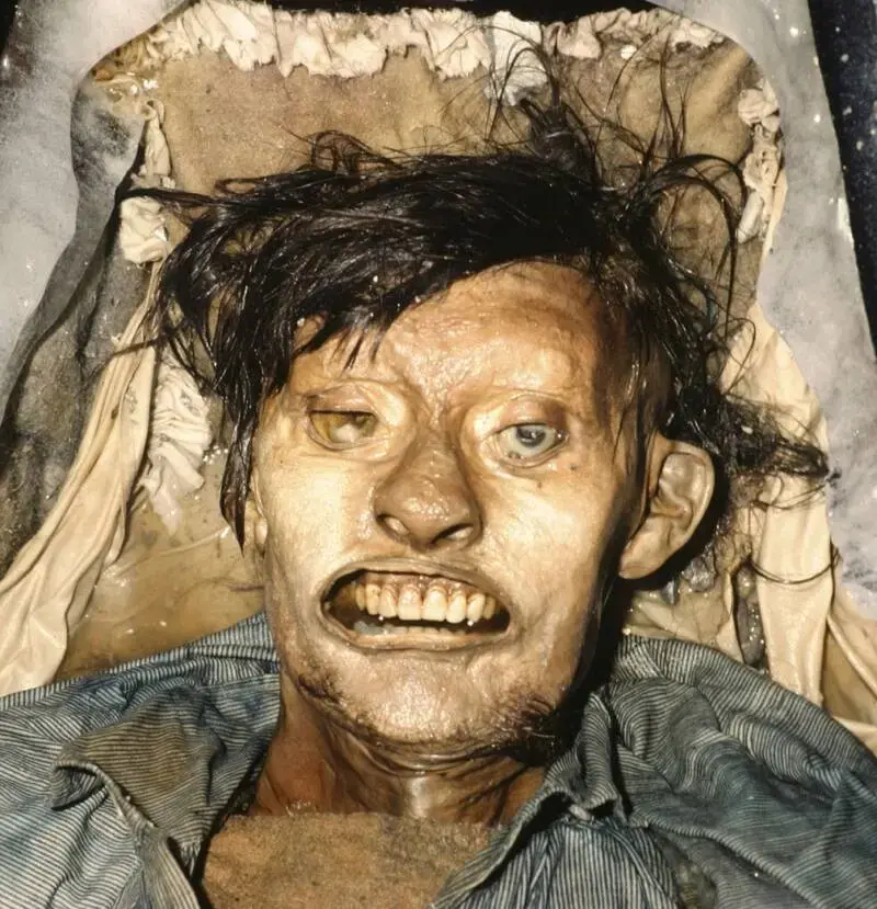 The Most Scandalously Preserved Mummy Ever Found: Unearthed at Franklin Execution Site in 1845, Revealing Chilling Secrets of the Past.